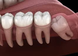 Чи можна лікувати зуби при температурі: важливі рекомендації і поради