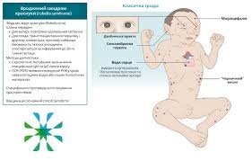 Чи можна вагітним гостре? Вплив спецій на здоров’я жінки