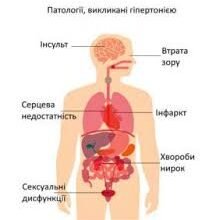 Гіпертонічна хвороба: 2 стадія, 3 ступінь, ризик 3 – все про загрози