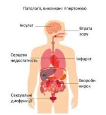 Гіпертонічна хвороба: 2 стадія, 3 ступінь, ризик 3 – все про загрози
