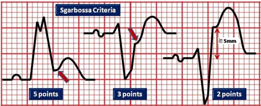 Зміни міокарда: основні причини, симптоми та методи лікування