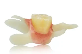 Метатуберкульозні зміни: причини, симптоми та способи лікування