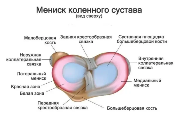 Дегенеративні зміни медіального меніска Stoller 2: симптоми, діагностика