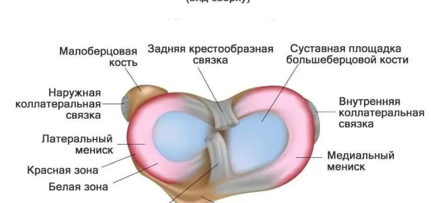Дегенеративні зміни медіального меніска Stoller 2: симптоми, діагностика Дегенеративні зміни медіального меніска Stoller 2: симптоми, діагностика