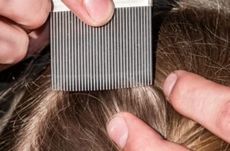 Як вивести воші у дитини: ефективні та безпечні методи боротьби