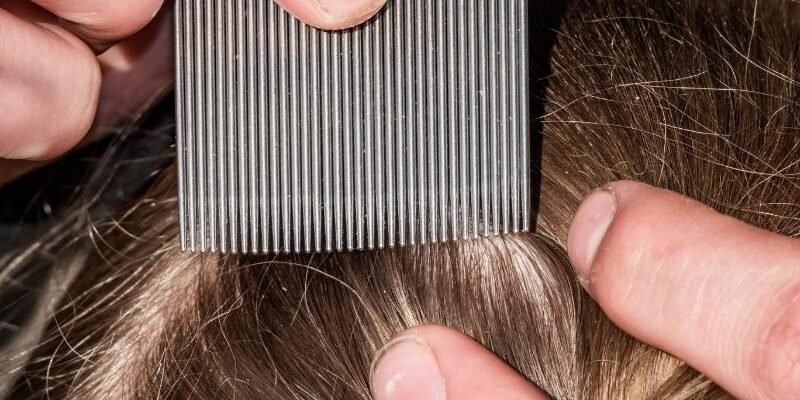 Як вивести воші у дитини: ефективні та безпечні методи боротьби Як вивести воші у дитини: ефективні та безпечні методи боротьби