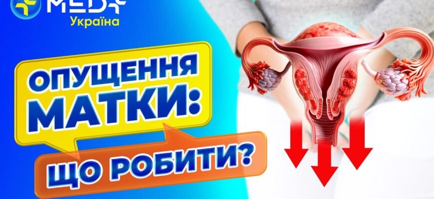 Вправи Кегеля при опущенні матки: відео та поради для жінок Вправи Кегеля при опущенні матки: відео та поради для жінок