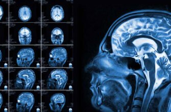 Чи можна робити МРТ з брекетами: поради та рекомендації спеціалістів