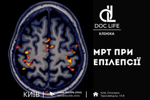 Загальномозкові зміни іритативного характеру: що це означає? Загальномозкові зміни іритативного характеру: що це означає?