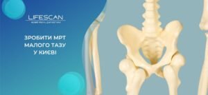 Чи можна робити МРТ з зубними імплантами: від чого залежить безпека?