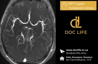 Вогнищеві зміни білої речовини головного мозку: причини і наслідки
