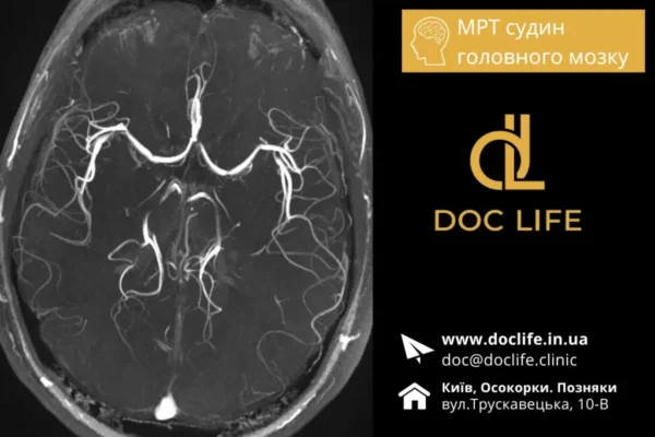 Вогнищеві зміни білої речовини головного мозку: причини і наслідки
