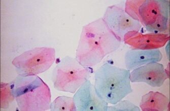 Що таке реактивні зміни епітелію: причини та наслідки для здоров’я