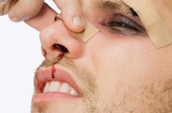 Перелом носа у дитини: як розпізнати та діяти правильно