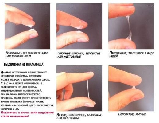 Які виділення при вагітності: норма та відхилення