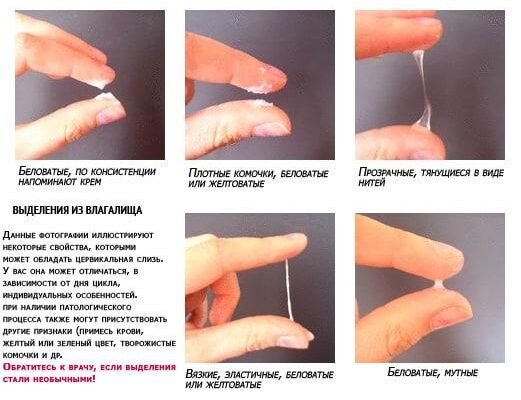 Які виділення при вагітності: норма та відхилення Які виділення при вагітності: норма та відхилення