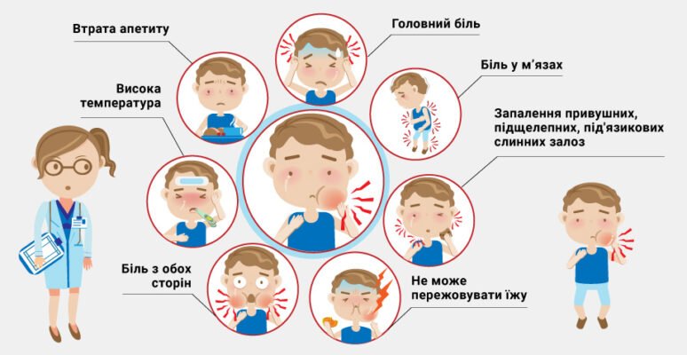 Свинка хвороба у дорослих: симптоми, причини та лікування
