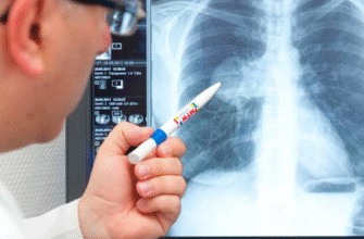 ШОЕ при запаленні легень: що це таке і як його знизити?