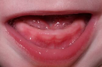 Ясна при прорізуванні зубів: поради з догляду та рекомендації