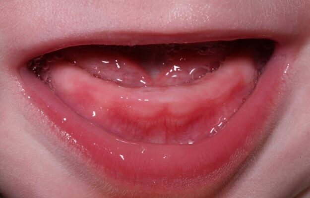 Ясна при прорізуванні зубів: поради з догляду та рекомендації