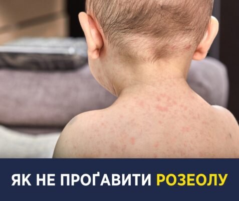 Висока температура у дитини без симптомів: що робити батькам?