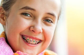Чи можна ставити брекети в 11 років: рекомендації стоматологів