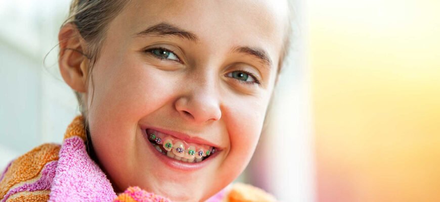 Чи можна ставити брекети в 11 років: рекомендації стоматологів