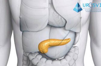 Дифузні зміни підшлункової залози: симптоми, причини та лікування