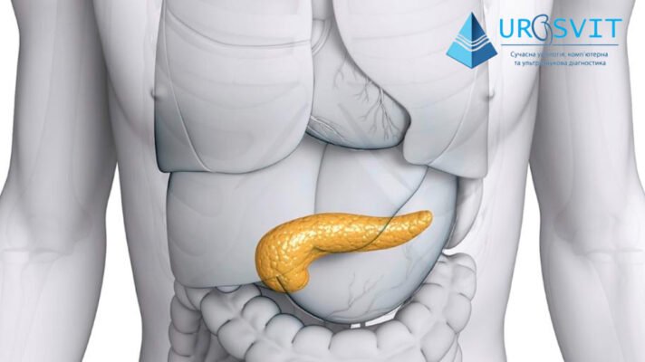 Дифузні зміни підшлункової залози: симптоми, причини та лікування