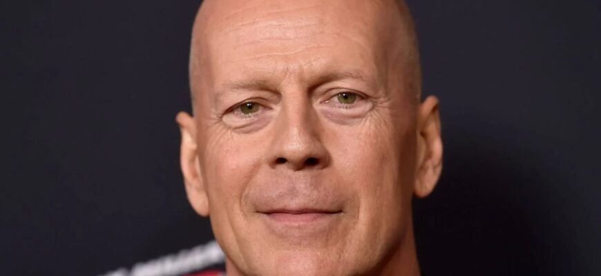 Анорак: функціональність і стиль в одязі для активного способу життя Анорак: функціональність і стиль в одязі для активного способу життя