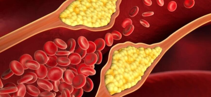 ЕТ на дисках: Вплив виліту на ефективність керування автомобілем