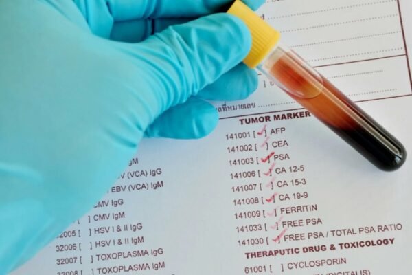 Гравіювання: техніки, інструменти та секрети майстерності для початківців