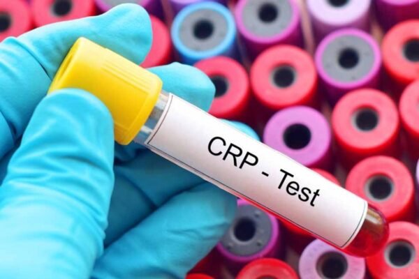 Переваги покупки та оренди житла у Варшаві з досвідченим рієлтором