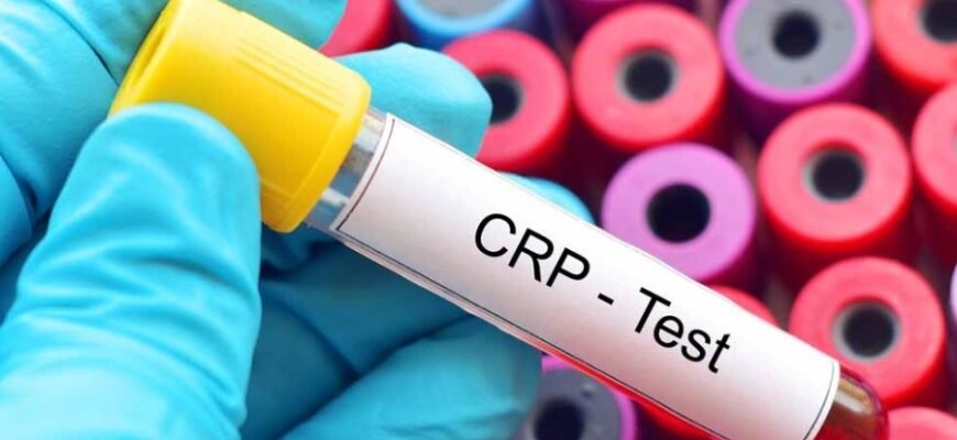 Переваги покупки та оренди житла у Варшаві з досвідченим рієлтором Переваги покупки та оренди житла у Варшаві з досвідченим рієлтором