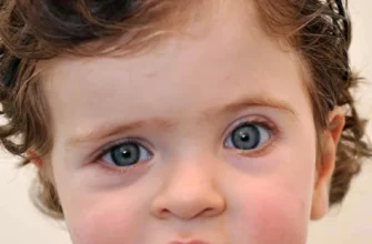 Плоска голова у дитини: що робити для виправлення форми?