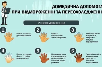 Перша медична допомога при обмороженні: важливі кроки та рекомендації