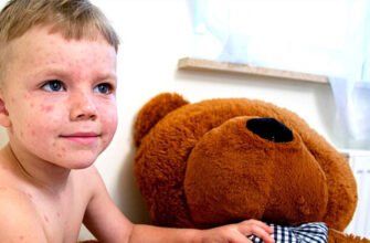 Кашель і висип у дитини: можливі причини та лікування