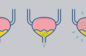 Симптоми інфекції сечовивідних шляхів: що варто знати для лікування