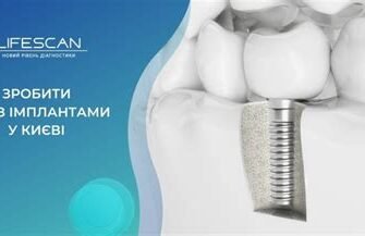 Чи можна робити МРТ з коронками: важлива інформація для пацієнтів