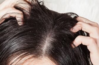 Лусочки на голові у дитини 8 років: причини та методи лікування