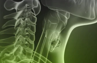 Чи можна вилікувати саркому: сучасні методи лікування та прогнози