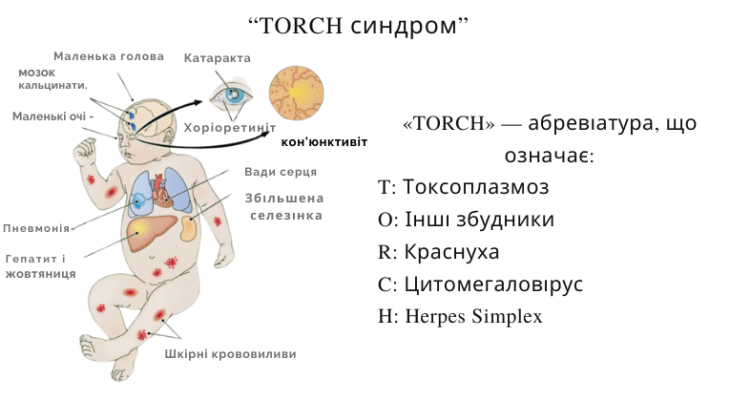 Інфекції: як захиститися та запобігти поширенню захворювань