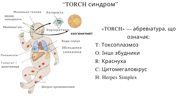 Інфекції: як захиститися та запобігти поширенню захворювань