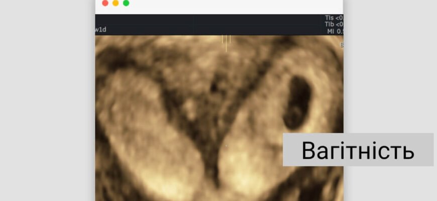 Дворога матка: чи можливо завагітніти з такою особливістю?