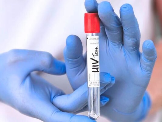 Гостра стадія ВІЛ-інфекції: найчастіші прояви та симптоми Гостра стадія ВІЛ-інфекції: найчастіші прояви та симптоми