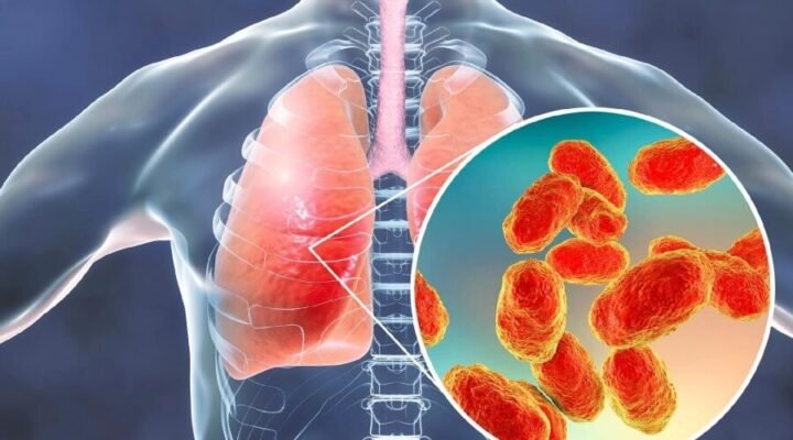 Запалення легенів у дитини: основні симптоми та ознаки хвороби