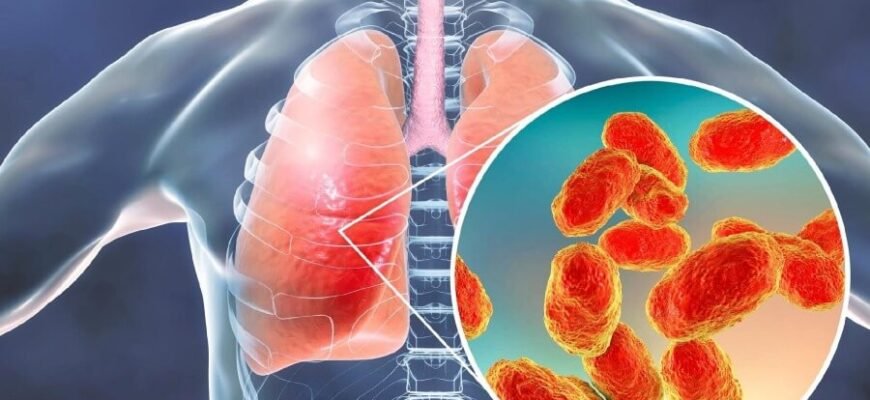 Запалення легенів у дитини: основні симптоми та ознаки хвороби