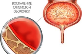 Причини та лікування: мутна сеча у дитини – що варто знати батькам