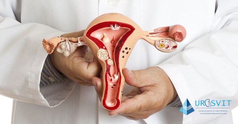 Статеві інфекції у жінок: симптоми, які важливо знати