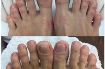 Подолог, що лікує: професійний догляд за вашими стопами